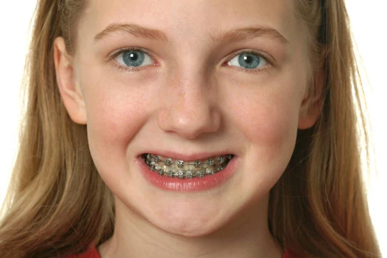 Choosing An Oral Irrigator for Braces Implants and Dentures