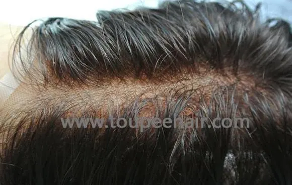 lace bleached knots