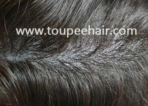 super thin skin tiny knots