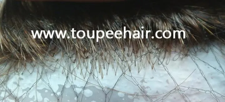 invisible front hairline