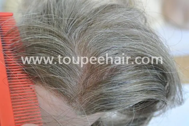 Invisible closure frontal