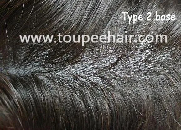 タイプ2 極小結び目スーパーシンスキンベース