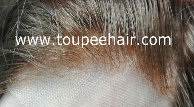 linha frontal de nós invisíveis em prótese feminina